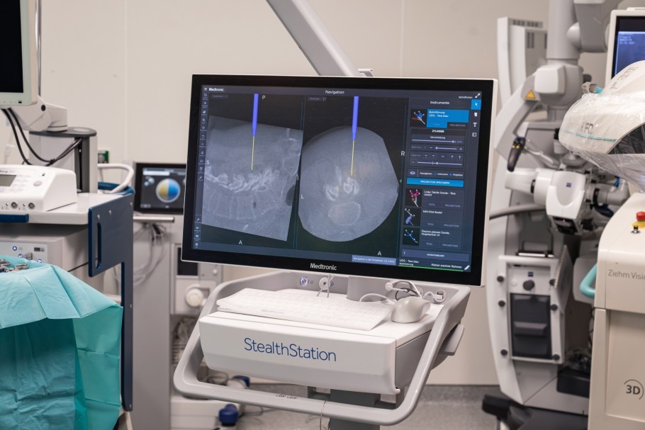 Endoskopische Wirbelsaeulenchirurgie 3
